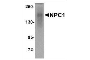 Western blot analysis of NPC1 in human kidney tissue lysate with this product at 1 μg/ml.