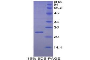 SDS-PAGE (SDS) image for Interleukin 1 alpha (IL1A) ELISA Kit (ABIN6574105)