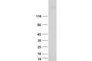 Validation with Western Blot (ATP2B4 Protein (Transcript Variant 2) (Myc-DYKDDDDK Tag))