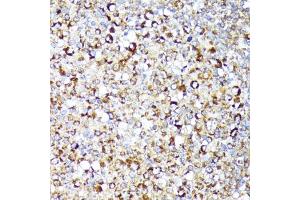 Immunohistochemistry of paraffin-embedded human tonsil using RIPK1/RIP antibody (ABIN6132596, ABIN6146959, ABIN6146960 and ABIN6223282) at dilution of 1:100 (40x lens).
