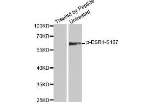 Western blot analysis of extracts from MCF7 cells using Phospho-ESR1-S167 antibody. (Estrogen Receptor alpha 抗体  (pSer167))