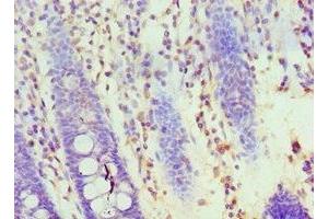 Immunohistochemistry of paraffin-embedded human colon tissue using ABIN7155707 at dilution of 1:100 (HOXA1 抗体  (AA 75-205))