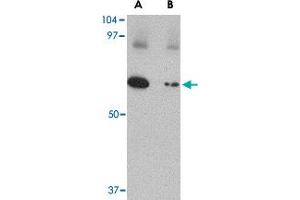 Western blot analysis of SLC22A17 in SK-N-SH lysate with SLC22A17 polyclonal antibody  at 1 ug/mL in (A) the absence and (B) the presence of blocking peptide.