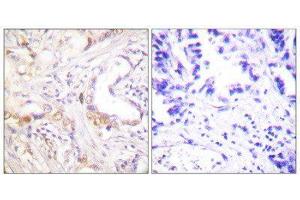 Immunohistochemistry (IHC) image for anti-Protein Inhibitor of Activated STAT, 3 (PIAS3) (N-Term) antibody (ABIN1848836) (PIAS3 抗体  (N-Term))