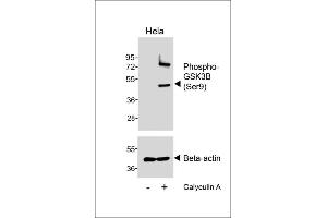 Western blot analysis of lysates from Hela cell line, untreated or treated with Calyculin A, 100nM, 30 min, using Phospho--GSK3B (Ser9) Antibody (upper) or Beta-actin (lower). (GSK3 beta 抗体  (pSer9))