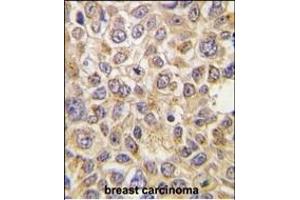 Immunohistochemistry (Paraffin-embedded Sections) (IHC (p)) image for anti-Solute Carrier Family 29 (Nucleoside Transporters), Member 4 (SLC29A4) (AA 39-69), (N-Term) antibody (ABIN387943)