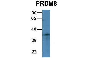 Host:  Rabbit  Target Name:  PRDM8  Sample Type:  293T  Antibody Dilution:  1. (PRDM8 抗体  (N-Term))