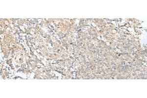 Immunohistochemistry of paraffin-embedded Human tonsil tissue using SLC26A3 Polyclonal Antibody at dilution of 1:35(x200) (SLC26A3 抗体)