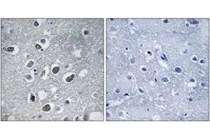 Immunohistochemistry analysis of paraffin-embedded human brain tissue, using MARCH4 Antibody. (MARCH4 抗体  (AA 301-350))