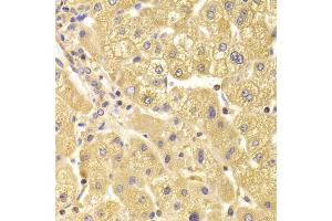 Immunohistochemistry of paraffin-embedded human liver injury using TRAF3IP2 Antibody (ABIN5974104) at dilution of 1/100 (40x lens). (TRAF3IP2 抗体)