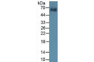 Mouse Capture antibody from the kit in WB with Positive Control: Sample Human cartilage tissue. (COL10 ELISA 试剂盒)