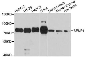 Western blot analysis of extracts of various cell lines, using SENP1 antibody. (SENP1 抗体  (AA 220-420))
