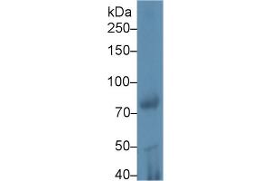 Western blot analysis of Rat Testis lysate, using Mouse iPLA2 Antibody (1 µg/ml) and HRP-conjugated Goat Anti-Rabbit antibody ( (PNPLA2 抗体  (AA 481-702))