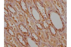 IHC image of MA004969A0m diluted at 1:100 and staining in paraffin-embedded human kidney tissue performed on a Leica BondTM system. (CD9 抗体  (AA 112-195))