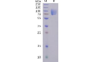 SDS-PAGE (SDS) image for SARS-CoV-2 Spike S1 (N-Term) protein (mFc Tag) (ABIN6961172)
