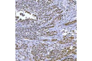 anti-Topoisomerase (DNA) III beta (TOP3B) (AA 128-824) antibody