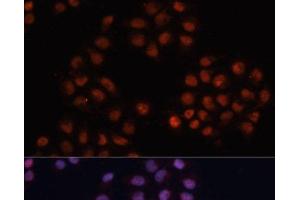 Immunofluorescence analysis of HeLa cells using CDKN1A Polyclonal Antibody at dilution of 1:100. (p21 抗体)