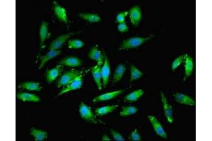 Immunofluorescent analysis of Hela cells using ABIN7151346 at dilution of 1:100 and Alexa Fluor 488-congugated AffiniPure Goat Anti-Rabbit IgG(H+L) (EML2 抗体  (AA 1-418))