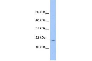 LOC285033 antibody used at 1 ug/ml to detect target protein. (LOC285033 抗体  (N-Term))