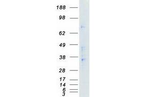 Western Blotting (WB) image for NIMA (Never in Mitosis Gene A)-Related Kinase 6 (NEK6) (Transcript Variant 2) protein (Myc-DYKDDDDK Tag) (ABIN2727081)