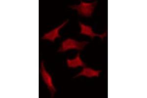 ABIN6267331 staining K562 by IF/ICC. (LYN 抗体  (pTyr507))