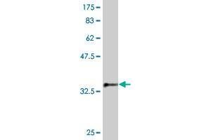 Western Blot detection against Immunogen (37. (SKP1 抗体  (AA 53-160))