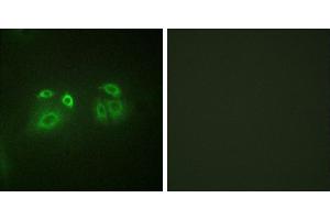 Peptide - +Immunofluorescence analysis of A549 cells, using Arrestin 1 (Ab-412) antibody. (SAG 抗体  (Ser412))
