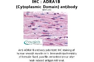 Image no. 1 for anti-Adrenergic, alpha-1B-, Receptor (ADRA1B) (3rd Cytoplasmic Domain) antibody (ABIN1731573)