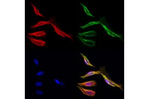ABIN6262297 and ABIN6276874 staining Hela cells by IF/ICC. (HMBS 抗体  (Internal Region))