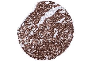 Parathyroid Parathyroid gland showing intense cytoplasmic PTH immunostaining of all glandular cells (Recombinant PTH 抗体  (AA 1-34))