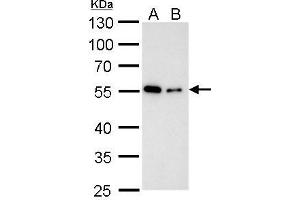WB Image Alpha Tubulin antibody detects alpha Tubulin protein by western blot analysis.