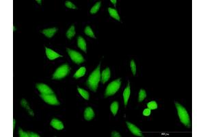 Immunofluorescence of purified MaxPab antibody to STAP1 on HeLa cell. (STAP1 抗体  (AA 1-295))