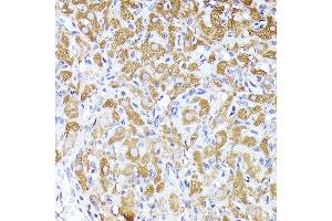 Immunohistochemistry of paraffin-embedded rat ovary using DBI Rabbit pAb (ABIN6127407, ABIN6139420, ABIN6139422 and ABIN6217234) at dilution of 1:250 (40x lens).