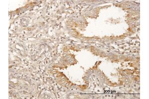Immunostaining (ISt) image for anti-Progestagen-Associated Endometrial Protein (PAEP) (AA 1-180) antibody (ABIN518583)