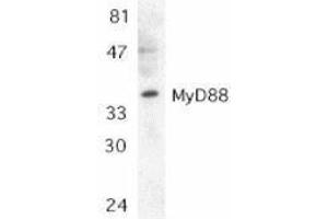 Western Blotting (WB) image for anti-Myeloid Differentiation Primary Response Gene (88) (MYD88) (AA 279-296) antibody (ABIN2475775) (MYD88 抗体  (AA 279-296))