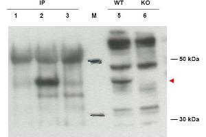 Image no. 1 for anti-Diaphanous Homolog 2 (DIAPH2) (AA 1085-1101), (Isoform 2) antibody (ABIN401289) (DIAPH2 抗体  (Isoform 2))