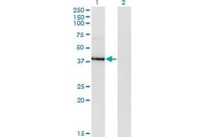 Western Blot analysis of HDAC8 expression in transfected 293T cell line by HDAC8 monoclonal antibody (M07), clone 2F4. (HDAC8 抗体  (AA 1-100))