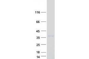 Western Blotting (WB) image for Leucine Rich Repeat Containing 3B (LRRC3B) protein (Myc-DYKDDDDK Tag) (ABIN2724915)