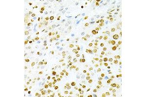 Immunohistochemistry (IHC) image for anti-Dyskeratosis Congenita 1, Dyskerin (DKC1) (AA 245-514) antibody (ABIN1512829)