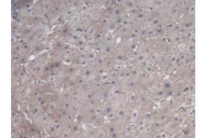 Detection of VEGF121 in Human Liver Tissue using Monoclonal Antibody to Vascular Endothelial Growth Factor 121 (VEGF121) (VEGF121 抗体  (AA 28-147))