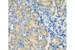 Immunohistochemistry of paraffin-embedded Rat kidney using C1S Polyclonal Antibody at dilution of 1:200 (40x lens). (C1S 抗体)
