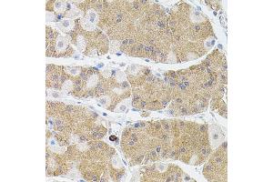 Immunohistochemistry of paraffin-embedded human stomach using MMP9 antibody (ABIN4904399) at dilution of 1:100 (40x lens). (MMP 9 抗体)