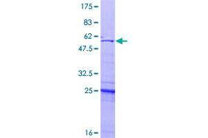 Image no. 1 for Ubiquitin-Conjugating Enzyme E2Z (UBE2Z) (AA 1-246) protein (GST tag) (ABIN1324420)
