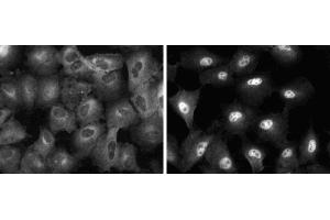 Immunofluorescent staining of A549 (ATCC CCL-185) cells. (NF-kB p65 抗体  (AA 136-224))