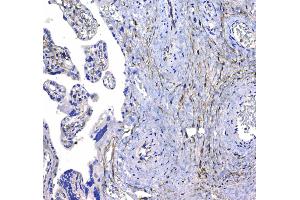 Immunohistochemistry (IHC) image for anti-CD44 (CD44) (AA 21-259) antibody (ABIN5692819)