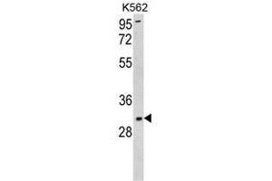 Western blot analysis of SOD3 Antibody (N-term) in K562 cell line lysates (35ug/lane). (SOD3 抗体  (N-Term))