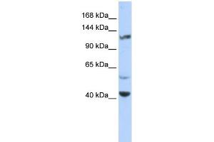 WB Suggested Anti-KCNH3 Antibody Titration:  0. (KCNH3 抗体  (Middle Region))