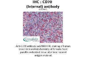 Image no. 2 for anti-CD70 Molecule (CD70) (Internal Region) antibody (ABIN1732875) (CD70 抗体  (Internal Region))