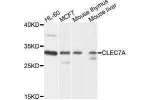 Western blot analysis of extracts of various cells, using CLEC7A antibody. (CLEC7A 抗体)