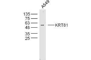 A594 lysates probed with KRT81 Polyclonal Antibody, Unconjugated  at 1:300 overnight at 4˚C. (KRT81 抗体  (AA 401-505))